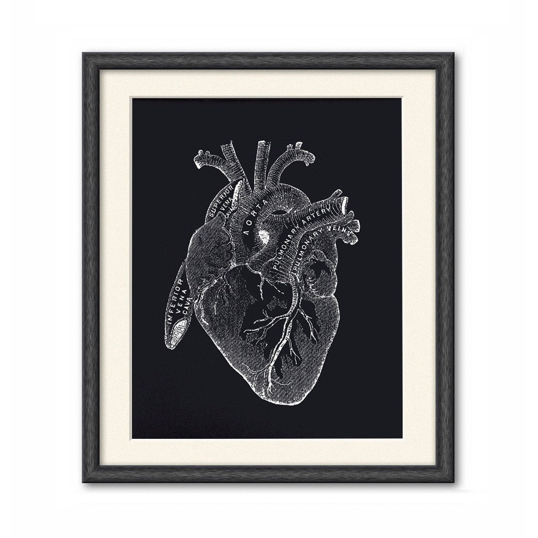 Vintage anatomy black heart print.  Educational biology chart diagram. Black background with white illustrations. Print in black frame with white mat